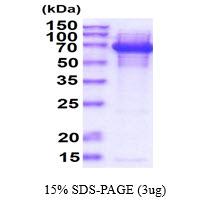 3 μg by SDS-PAGE under reducing condition and visualized by coomassie blue stain.